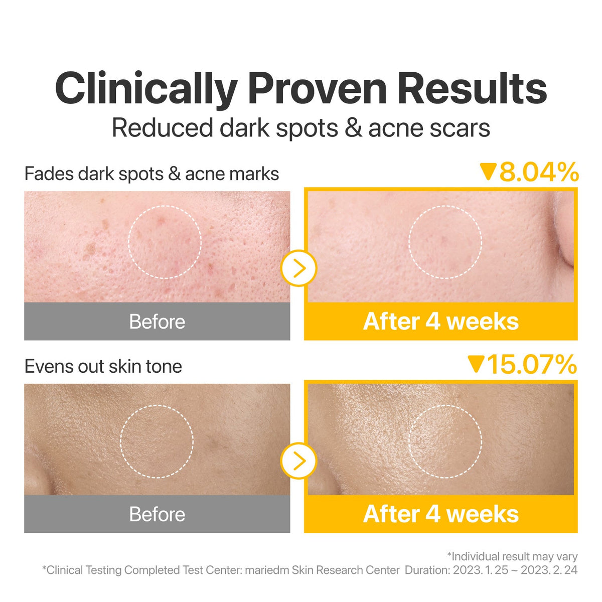 Numbuzin No.5 Vitamin-Niacinamide Toner Pads application