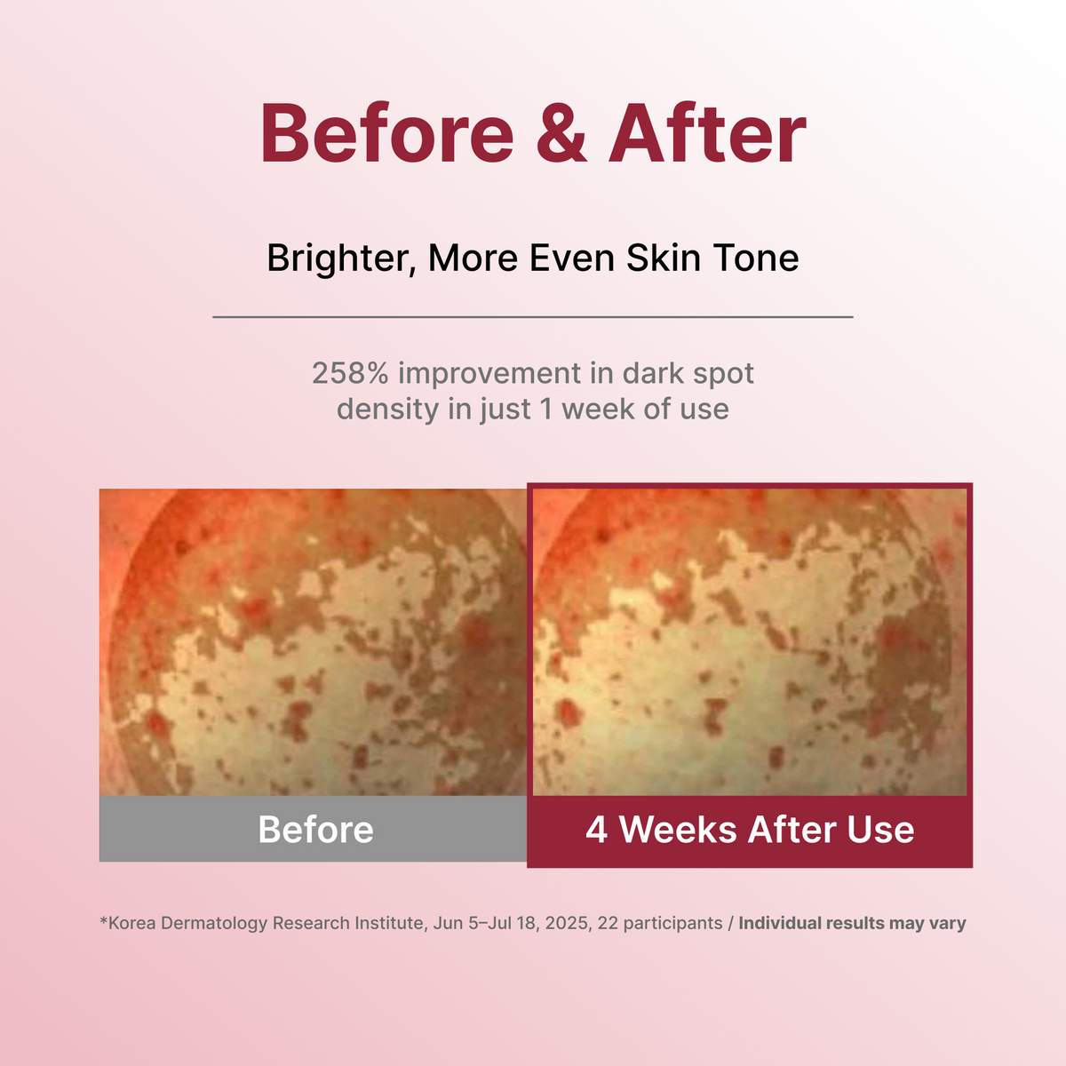 Centellian24 Mela Capture Ampoule application