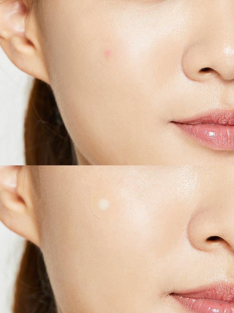 COSRX Acne Pimple Master Patch packaging back