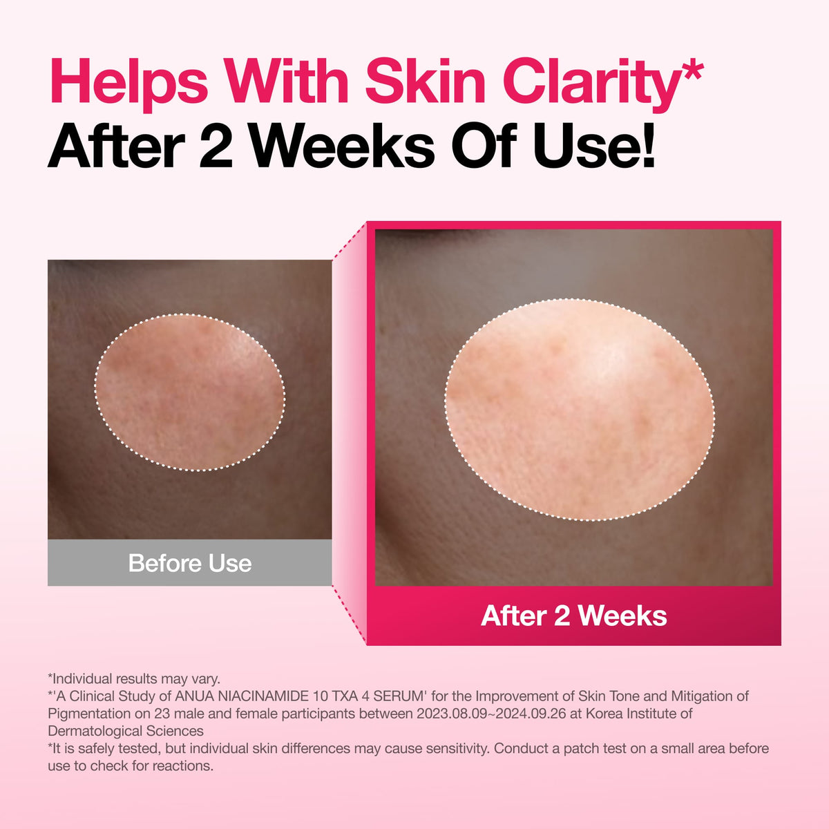 Anua Niacinamide 10% + TXA 4% Serum bottle detail